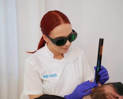 Why Traditional Methods Fail and Re-Vio Doesn’t